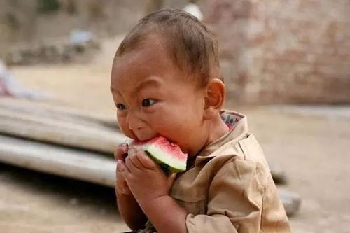 吃小瓜右腹痛,探寻右腹不适的真相